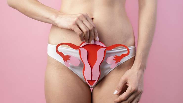¿Qué debe saber acerca de la endometriosis?